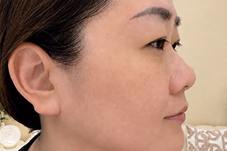 JANE LATI 蓁菈䔶全膚管理的敏感肌亮顏 SPA 顧客好評分享，展現溫和不刺激的肌膚提亮過程與舒緩效果。